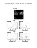 MAGNETIC RESONANCE IMAGING DEVICE diagram and image