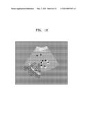 METHOD AND APPARATUS FOR GENERATING AN IMAGE OF AN ORGAN diagram and image