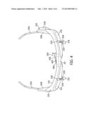 Coating Inspection Device diagram and image