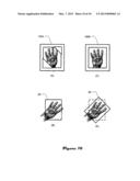 INDEPENDENTLY ROTATABLE DETECTOR PLATE FOR MEDICAL IMAGING DEVICE diagram and image