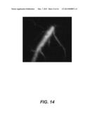 Bioluminescent Endoscopy Methods and Compounds diagram and image