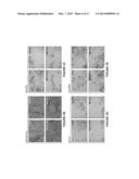 LIPOSOMES CONTAINING OLIGOPEPTIDE FRAGMENTS OF MYELIN BASIC PROTEIN, A     PHARMACEUTICAL COMPOSITION AND A METHOD FOR TREATMENT OF MULTIPLE     SCLEROSIS diagram and image