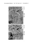 BIOACTIVE BONE GRAFT SUBSTITUTE diagram and image