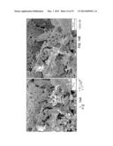 BIOACTIVE BONE GRAFT SUBSTITUTE diagram and image