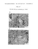 BIOACTIVE BONE GRAFT SUBSTITUTE diagram and image