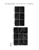 METHOD FOR EARLY DETECTION OF CANCER diagram and image