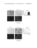 Compositions and Methods for Characterizing Breast Cancer diagram and image