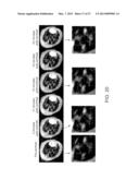 Compositions and Methods for Characterizing Breast Cancer diagram and image