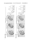 Compositions and Methods for Characterizing Breast Cancer diagram and image