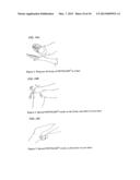 TREATMENT OF PAIN WITH TOPICAL DICLOFENAC diagram and image