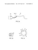 ENDOLUMINAL AND TRANSLUMINAL SURGICAL METHODS AND DEVICES diagram and image