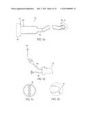 ENDOLUMINAL AND TRANSLUMINAL SURGICAL METHODS AND DEVICES diagram and image