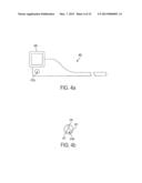 ENDOLUMINAL AND TRANSLUMINAL SURGICAL METHODS AND DEVICES diagram and image