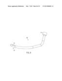 ENDOLUMINAL AND TRANSLUMINAL SURGICAL METHODS AND DEVICES diagram and image