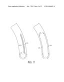 ENDOLUMINAL AND TRANSLUMINAL SURGICAL METHODS AND DEVICES diagram and image