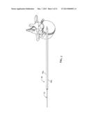 SURGICAL ACCESS SYSTEM AND RELATED METHODS diagram and image