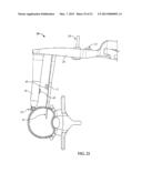 SURGICAL ACCESS SYSTEM AND RELATED METHODS diagram and image