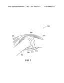 METHOD AND SYSTEM FOR ULTRASOUND BASED AUTOMATED DETECTION, QUANTIFICATION     AND TRACKING OF PATHOLOGIES diagram and image