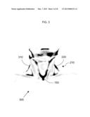 METHOD FOR DETERMINING BREAST VOLUME TO ASSIST MEDICAL PROCEDURE diagram and image