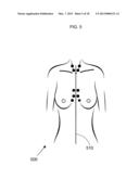 METHOD FOR DETERMINING BREAST VOLUME TO ASSIST MEDICAL PROCEDURE diagram and image