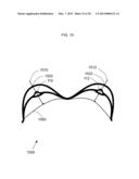 METHOD FOR DETERMINING BREAST VOLUME TO ASSIST MEDICAL PROCEDURE diagram and image