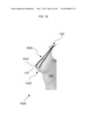 METHOD FOR DETERMINING BREAST VOLUME TO ASSIST MEDICAL PROCEDURE diagram and image