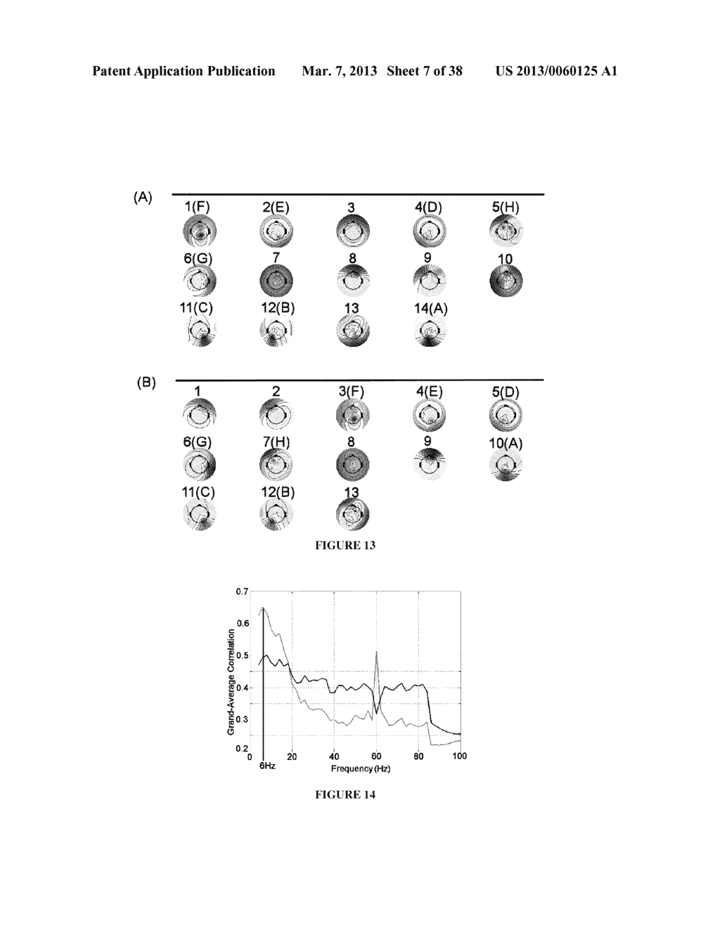 ENCEPHALOGRAPHY METHOD AND APPARATUS INCORPORATING INDEPENDENT COMPONENT     ANALYSIS AND A SPECTRAL SHAPING FILTER - diagram, schematic, and image 08