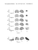 ENCEPHALOGRAPHY METHOD AND APPARATUS INCORPORATING INDEPENDENT COMPONENT     ANALYSIS AND A SPECTRAL SHAPING FILTER diagram and image