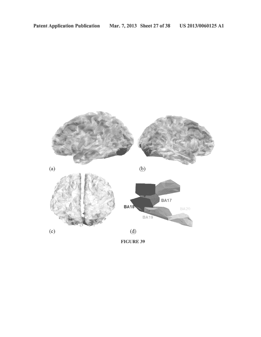 ENCEPHALOGRAPHY METHOD AND APPARATUS INCORPORATING INDEPENDENT COMPONENT     ANALYSIS AND A SPECTRAL SHAPING FILTER - diagram, schematic, and image 28