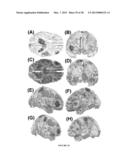 ENCEPHALOGRAPHY METHOD AND APPARATUS INCORPORATING INDEPENDENT COMPONENT     ANALYSIS AND A SPECTRAL SHAPING FILTER diagram and image