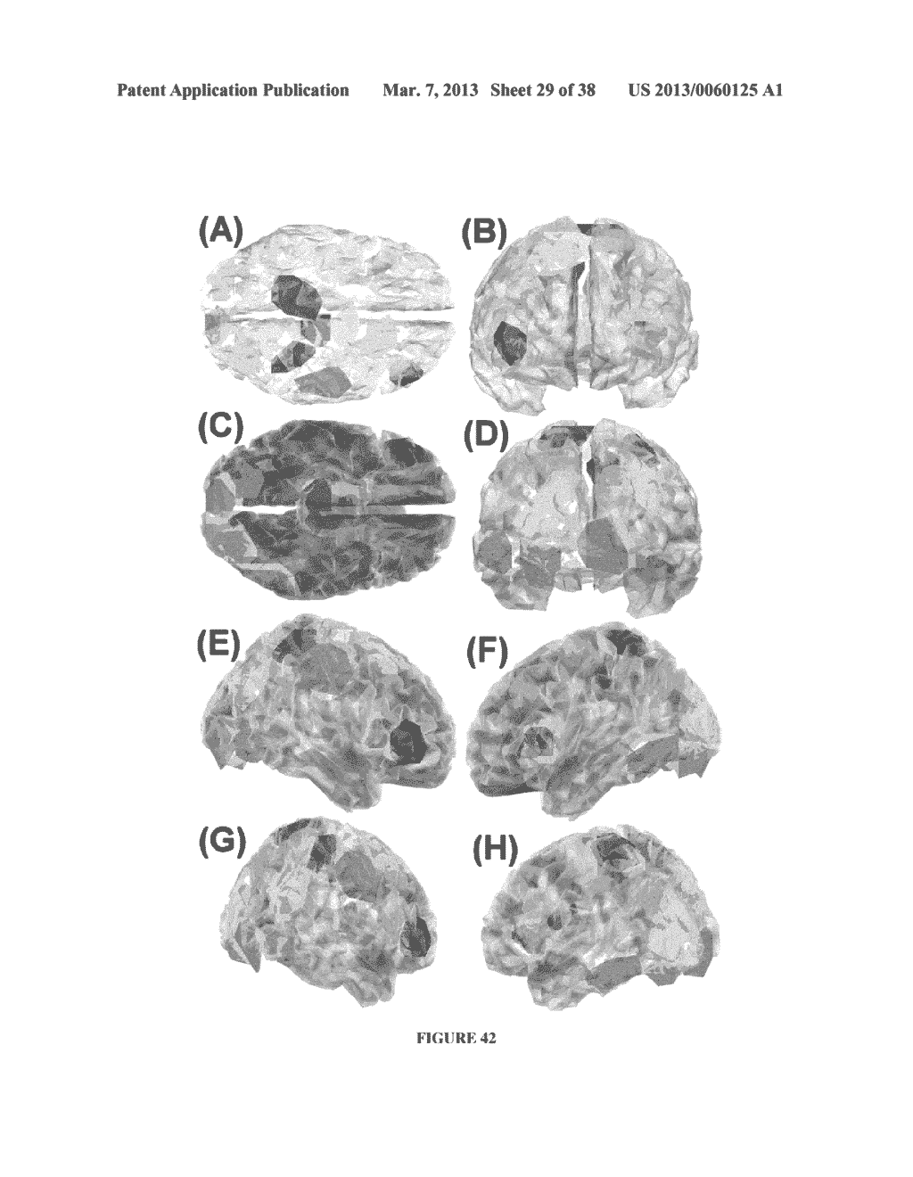 ENCEPHALOGRAPHY METHOD AND APPARATUS INCORPORATING INDEPENDENT COMPONENT     ANALYSIS AND A SPECTRAL SHAPING FILTER - diagram, schematic, and image 30