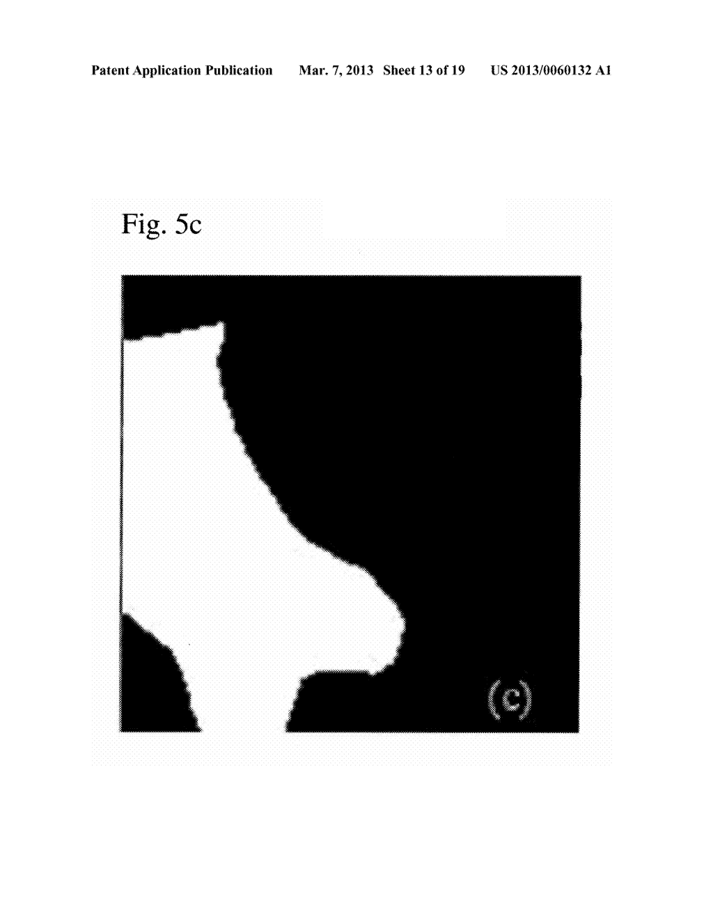 AUTOMATIC DETECTION OF CONTRAST INJECTION - diagram, schematic, and image 14