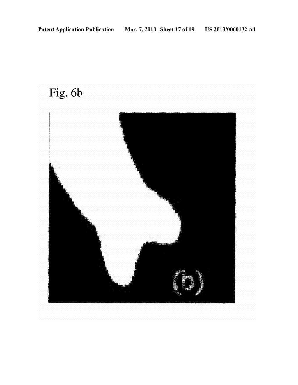 AUTOMATIC DETECTION OF CONTRAST INJECTION - diagram, schematic, and image 18