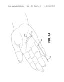 METHOD AND APPARATUS FOR REPAIRING A TENDON OR LIGAMENT diagram and image