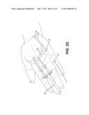 METHOD AND APPARATUS FOR REPAIRING A TENDON OR LIGAMENT diagram and image