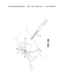 METHOD AND APPARATUS FOR REPAIRING A TENDON OR LIGAMENT diagram and image