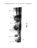 METHOD AND APPARATUS FOR REPAIRING A TENDON OR LIGAMENT diagram and image