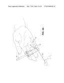 METHOD AND APPARATUS FOR REPAIRING A TENDON OR LIGAMENT diagram and image