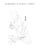 METHOD AND APPARATUS FOR REPAIRING A TENDON OR LIGAMENT diagram and image