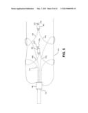 METHOD AND APPARATUS FOR REPAIRING A TENDON OR LIGAMENT diagram and image