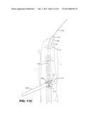 METHOD AND APPARATUS FOR REPAIRING A TENDON OR LIGAMENT diagram and image