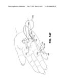 METHOD AND APPARATUS FOR REPAIRING A TENDON OR LIGAMENT diagram and image