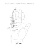 METHOD AND APPARATUS FOR REPAIRING A TENDON OR LIGAMENT diagram and image