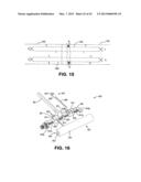 METHOD AND APPARATUS FOR REPAIRING A TENDON OR LIGAMENT diagram and image