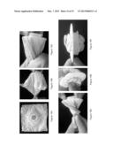 DISPOSABLE OSTOMY ASSEMBLIES diagram and image