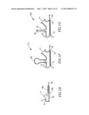 INTUSSUSCEPTING BALLOON CATHETER AND METHODS FOR CONSTRUCTING AND USING     THEREOF diagram and image