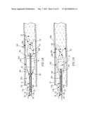 INTUSSUSCEPTING BALLOON CATHETER AND METHODS FOR CONSTRUCTING AND USING     THEREOF diagram and image