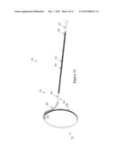 CATHETER SHAPE ADJUSTMENT MECHANISM diagram and image