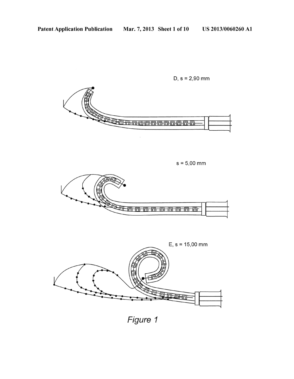 Multi-actuator array for the specific deformation of an implant - diagram, schematic, and image 02