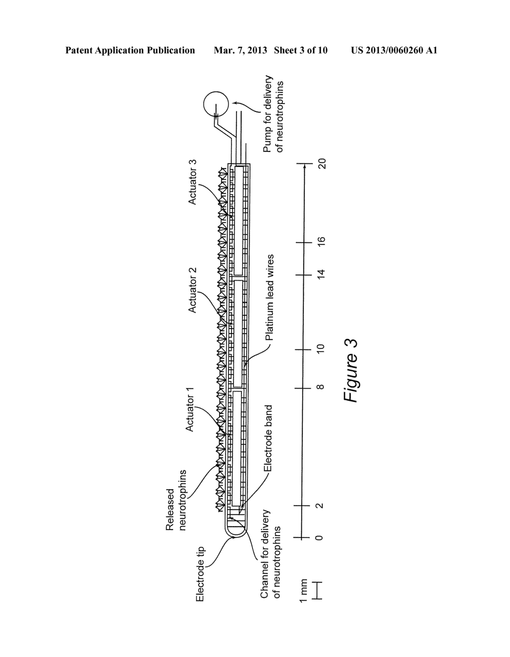 Multi-actuator array for the specific deformation of an implant - diagram, schematic, and image 04